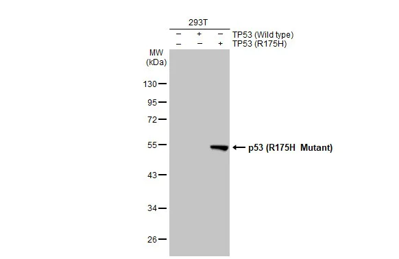 Western blot - Anti-p53 R175H Mutant antibody [HL1129] (AB308342)