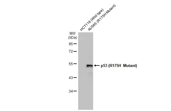 Western blot - Anti-p53 R175H Mutant antibody [HL1129] (AB308342), expandable thumbnail