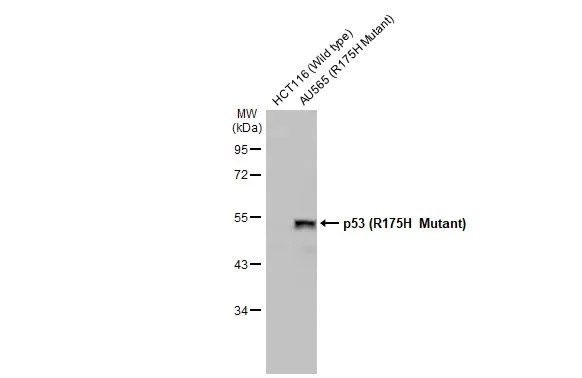 Western blot - Anti-p53 R175H Mutant antibody [HL1129] (AB308342)