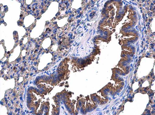 Immunohistochemistry (Formalin/PFA-fixed paraffin-embedded sections) - Anti-p53R2 antibody (AB227291)