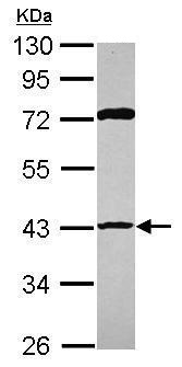Western blot - Anti-p53R2 antibody (AB227291)