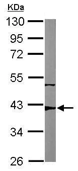 Western blot - Anti-p53R2 antibody (AB227291)