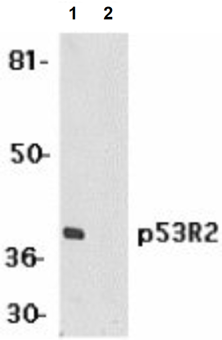 Western blot - Anti-p53R2 antibody (AB8105)