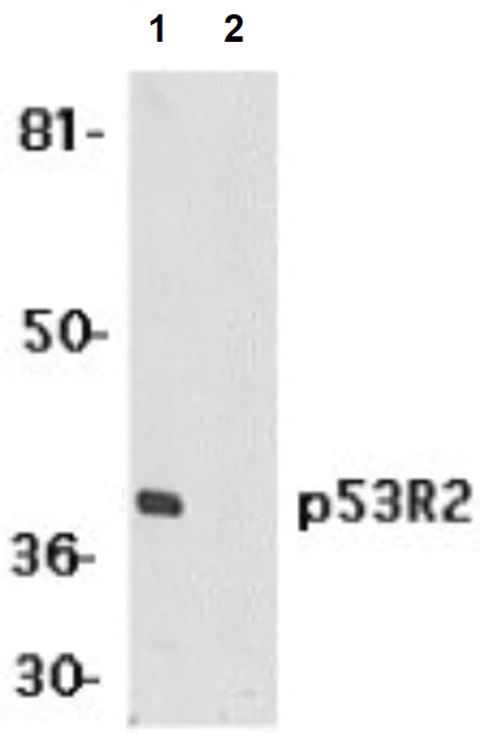 Western blot - Anti-p53R2 antibody (AB8105)