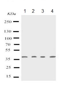 Western blot - Anti-p53R2 antibody - C-terminal (AB191055)