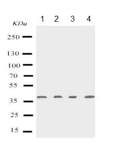 Western blot - Anti-p53R2 antibody - C-terminal (AB191055)