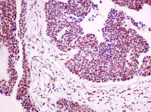 Immunohistochemistry (Formalin/PFA-fixed paraffin-embedded sections) - Anti-p53R2 antibody [EPR8816] (AB154194)