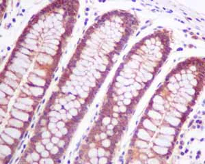Immunohistochemistry (Formalin/PFA-fixed paraffin-embedded sections) - Anti-p53R2 antibody [EPR8816] (AB154194)