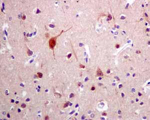 Immunohistochemistry (Formalin/PFA-fixed paraffin-embedded sections) - Anti-p53R2 antibody [EPR8816] (AB154194)