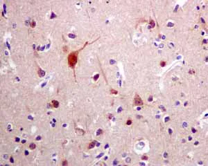 Immunohistochemistry (Formalin/PFA-fixed paraffin-embedded sections) - Anti-p53R2 antibody [EPR8816] (AB154194)