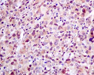 Immunohistochemistry (Formalin/PFA-fixed paraffin-embedded sections) - Anti-p53R2 antibody [EPR8816] (AB154194)