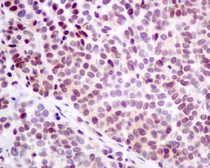Immunohistochemistry (Formalin/PFA-fixed paraffin-embedded sections) - Anti-p53R2 antibody [EPR8816] (AB154194)