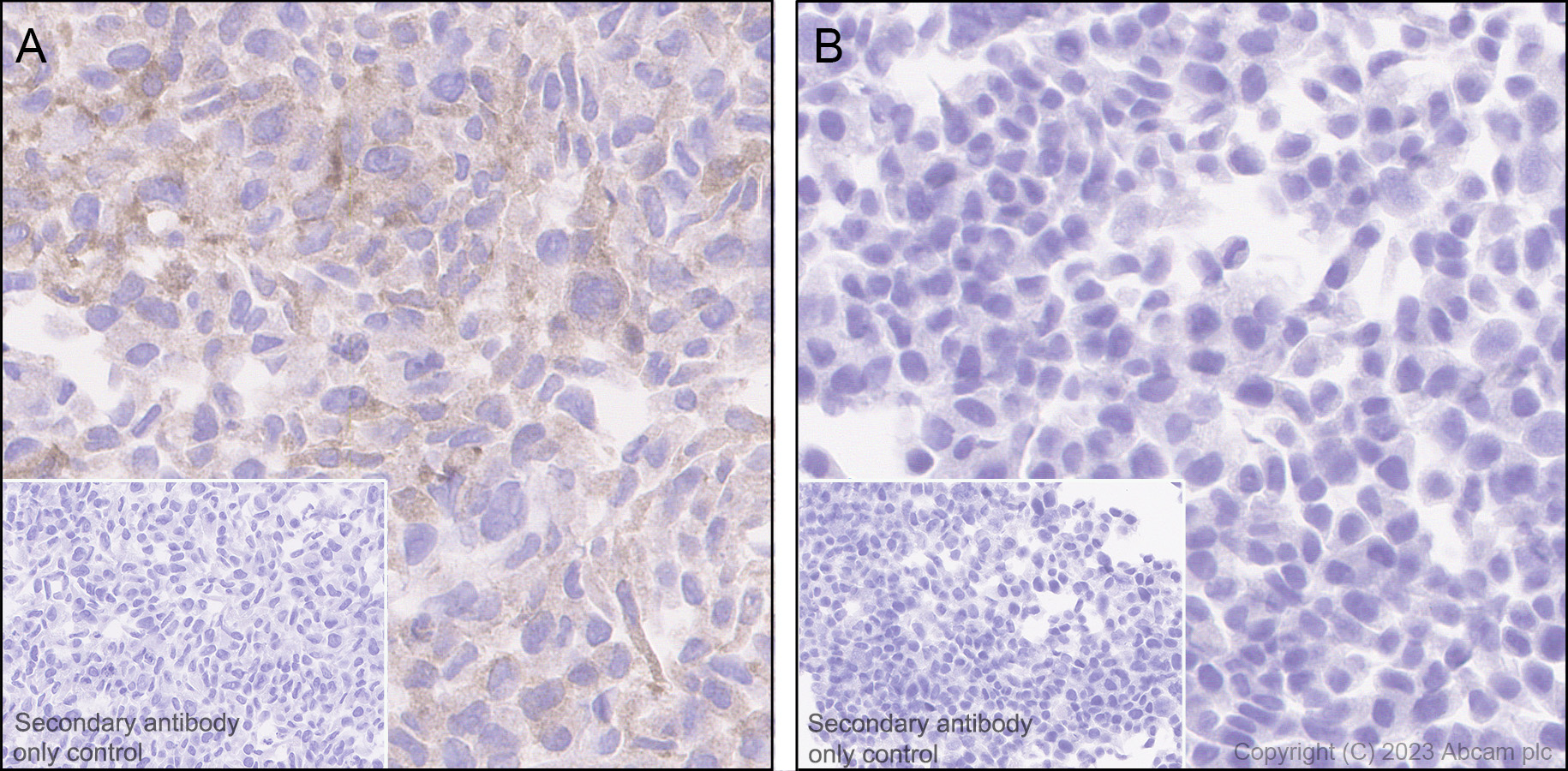 Immunohistochemistry (Formalin/PFA-fixed paraffin-embedded sections) - Anti-p53R2 antibody [EPR8816] (AB154194)