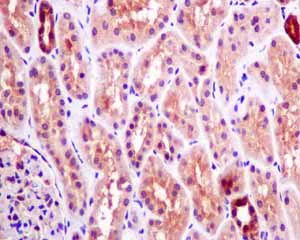 Immunohistochemistry (Formalin/PFA-fixed paraffin-embedded sections) - Anti-p53R2 antibody [EPR8816] (AB154194)