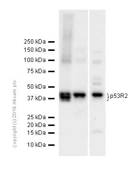 Western blot - Anti-p53R2 antibody [EPR8816] (AB154194)