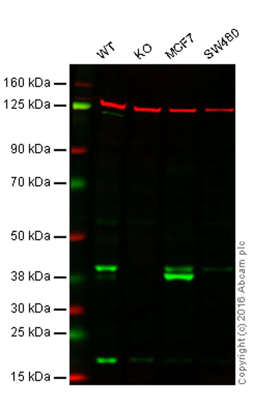 Western blot - Anti-p53R2 antibody [EPR8816] (AB154194)