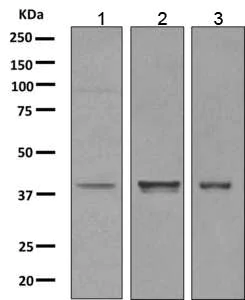Western blot - Anti-p53R2 antibody [EPR8816] (AB154194)