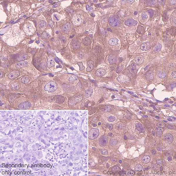 Immunohistochemistry (Formalin/PFA-fixed paraffin-embedded sections) - Anti-p53R2 antibody [EPR8816] - BSA and Azide free (AB249090)