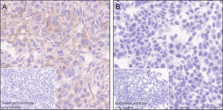 Immunohistochemistry (Formalin/PFA-fixed paraffin-embedded sections) - Anti-p53R2 antibody [EPR8816] - BSA and Azide free (AB249090)