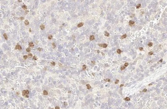 Immunohistochemistry paraffin embedded sections - Anti-p53R2 antibody [HL1400] (AB308366), expandable thumbnail