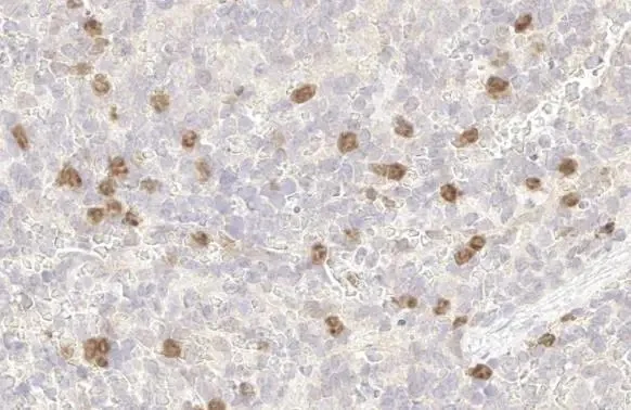 Immunohistochemistry paraffin embedded sections - Anti-p53R2 antibody [HL1400] (AB308366)