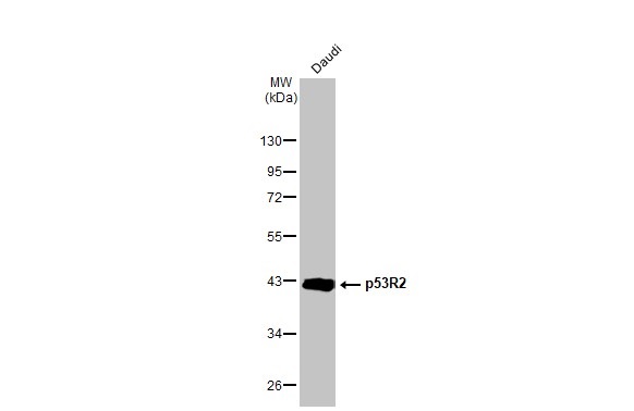 Western blot - Anti-p53R2 antibody [HL1400] (AB308366), expandable thumbnail