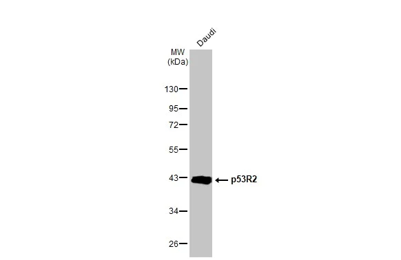 Western blot - Anti-p53R2 antibody [HL1400] (AB308366)