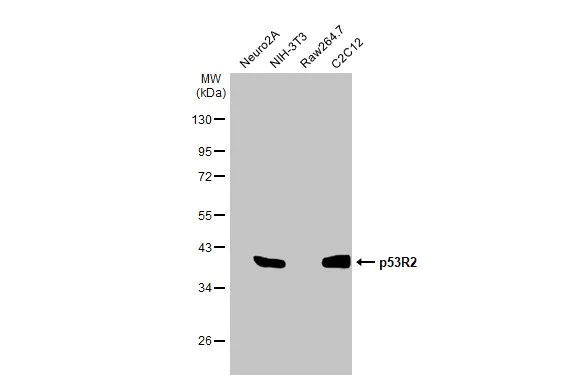 Western blot - Anti-p53R2 antibody [HL1400] (AB308366)
