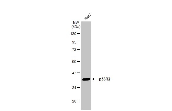 Western blot - Anti-p53R2 antibody [HL1400] (AB308366), expandable thumbnail