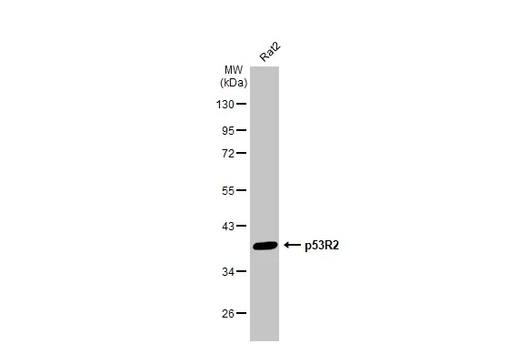 Western blot - Anti-p53R2 antibody [HL1400] (AB308366)