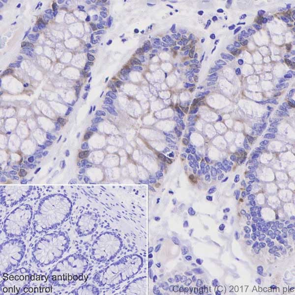 Immunohistochemistry (Formalin/PFA-fixed paraffin-embedded sections) - Anti-p53R2 + RRM2 antibody [EPR20651] (AB209995)