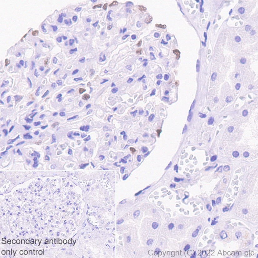 Immunohistochemistry (Formalin/PFA-fixed paraffin-embedded sections) - Anti-p57 Kip2 antibody [EP2718(2)] (AB133531), expandable thumbnail