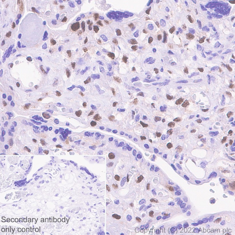 Immunohistochemistry (Formalin/PFA-fixed paraffin-embedded sections) - Anti-p57 Kip2 antibody [EP2718(2)] (AB133531), expandable thumbnail