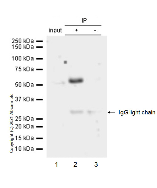 Immunoprecipitation - Anti-p57 Kip2 antibody [EP2718(2)] (AB133531), expandable thumbnail