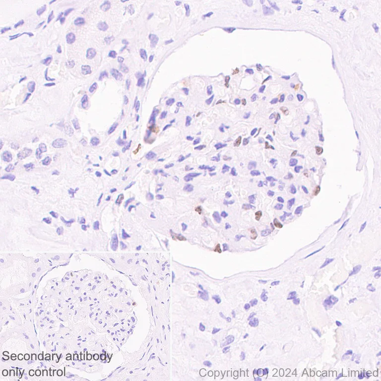 Immunohistochemistry (Formalin/PFA-fixed paraffin-embedded sections) - Anti-p57 Kip2 antibody [EP2718(2)] - BSA and Azide free (AB284805)