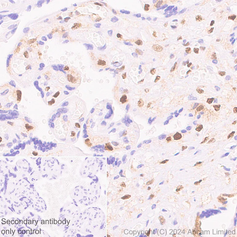 Immunohistochemistry (Formalin/PFA-fixed paraffin-embedded sections) - Anti-p57 Kip2 antibody [EP2718(2)] - BSA and Azide free (AB284805)