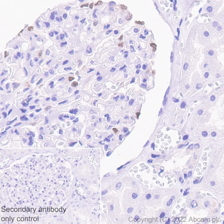 Immunohistochemistry (Formalin/PFA-fixed paraffin-embedded sections) - Anti-p57 Kip2 antibody [EP2718(2)] - BSA and Azide free (AB284805)