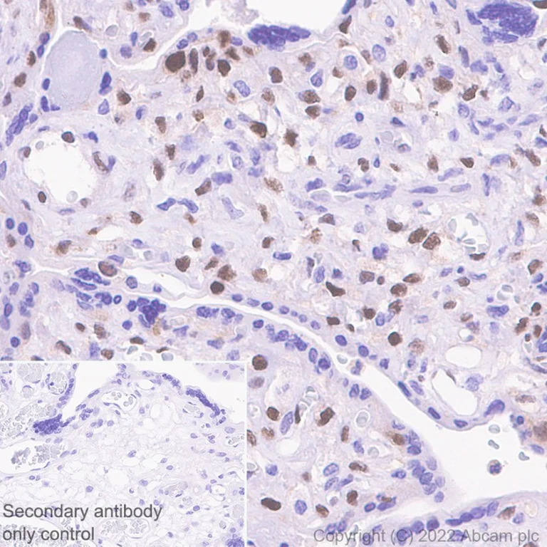 Immunohistochemistry (Formalin/PFA-fixed paraffin-embedded sections) - Anti-p57 Kip2 antibody [EP2718(2)] - BSA and Azide free (AB284805)