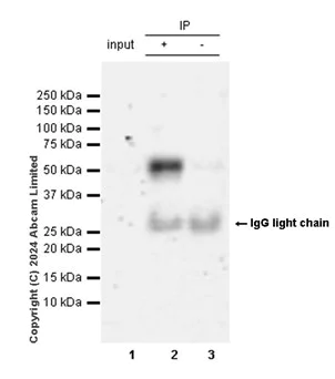 Immunoprecipitation - Anti-p57 Kip2 antibody [EP2718(2)] - BSA and Azide free (AB284805)
