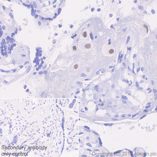 Immunohistochemistry (Formalin/PFA-fixed paraffin-embedded sections) - Anti-p57 Kip2 antibody [SP118] (AB231439)