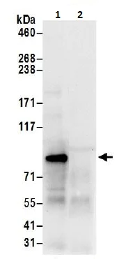 Immunoprecipitation - Anti-P5CS antibody (AB206682)