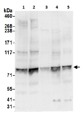 Western blot - Anti-P5CS antibody (AB206682)