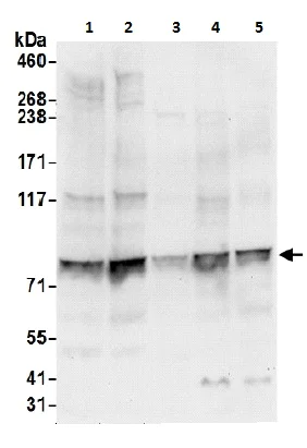 Western blot - Anti-P5CS antibody (AB206682)
