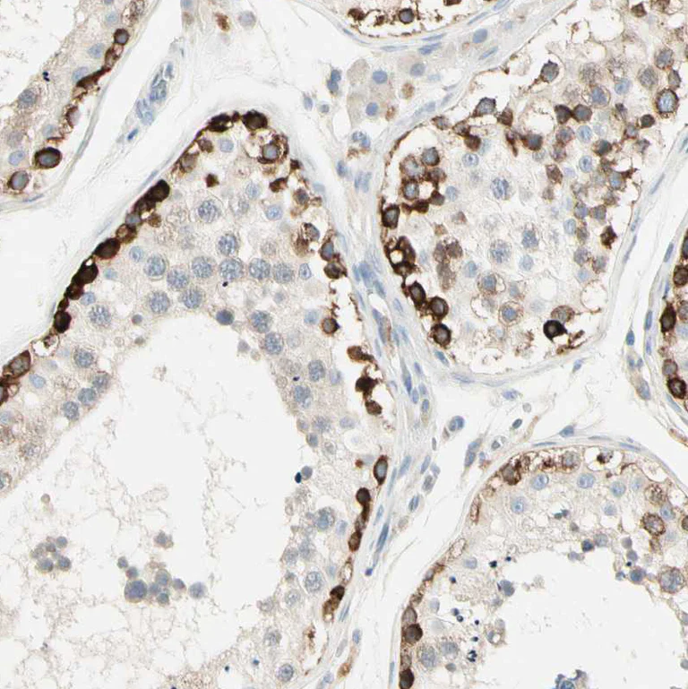 Immunohistochemistry (Formalin/PFA-fixed paraffin-embedded sections) - Anti-P5CS antibody (AB223713)