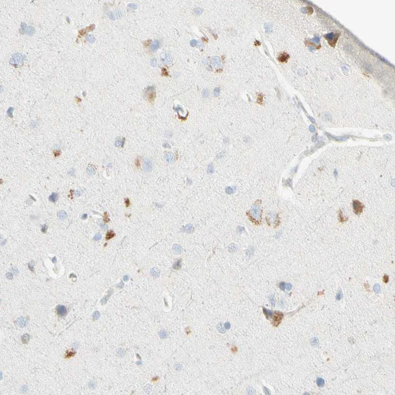 Immunohistochemistry (Formalin/PFA-fixed paraffin-embedded sections) - Anti-P5CS antibody (AB223713)