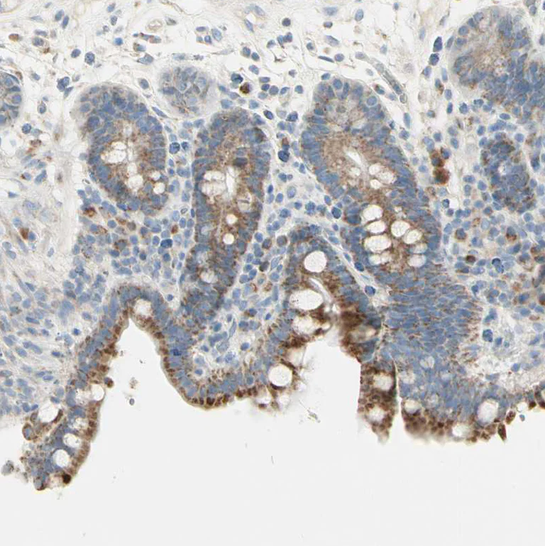 Immunohistochemistry (Formalin/PFA-fixed paraffin-embedded sections) - Anti-P5CS antibody (AB223713)