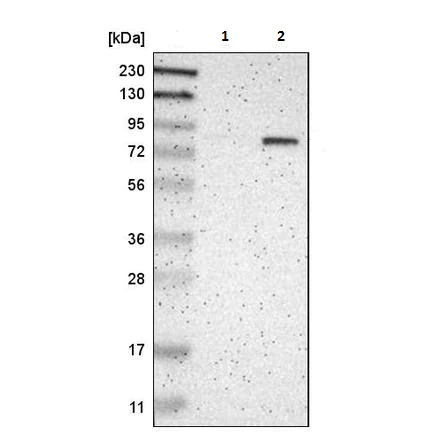 Western blot - Anti-P5CS antibody (AB223713)
