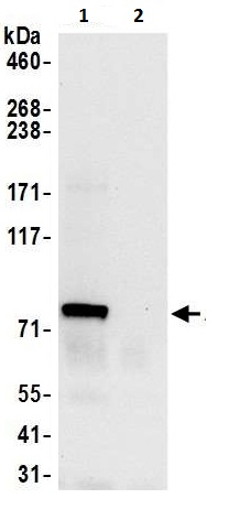 Immunoprecipitation - Anti-P5CS antibody (AB225999)