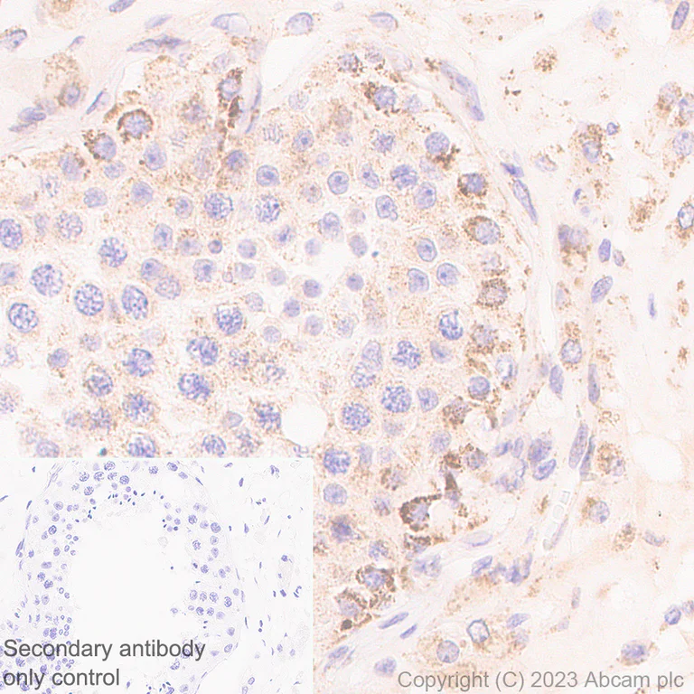 Immunohistochemistry (Formalin/PFA-fixed paraffin-embedded sections) - Anti-P5CS antibody [EPR28827-56] - BSA and Azide free (AB315817)