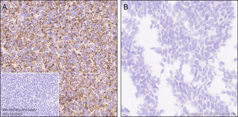 Immunohistochemistry (Formalin/PFA-fixed paraffin-embedded sections) - Anti-P5CS antibody [EPR28827-56] - BSA and Azide free (AB315817)
